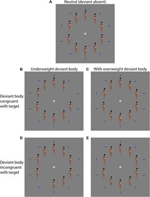 Female Body Dissatisfaction and Attentional Bias to Body Images Evaluated Using Visual Search